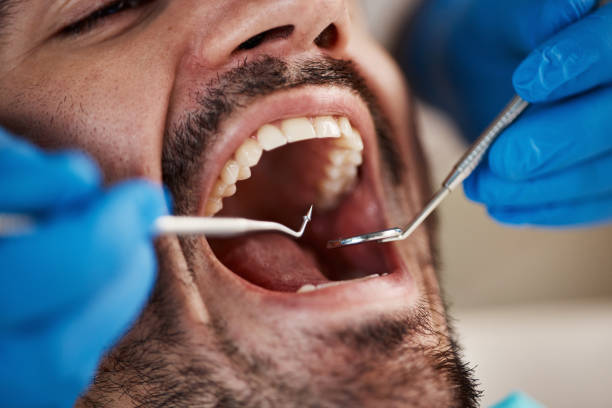 Best Emergency Treatment for Oral Infections in Adwolf, VA