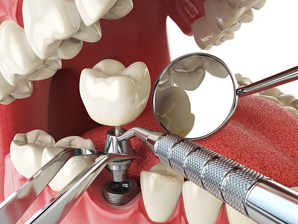Best Dental Abscess Treatment in Adwolf, VA