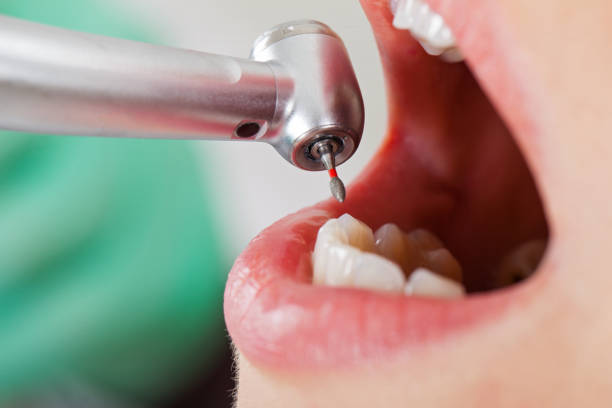 Best Emergency Care for Gum Disease in Adwolf, VA